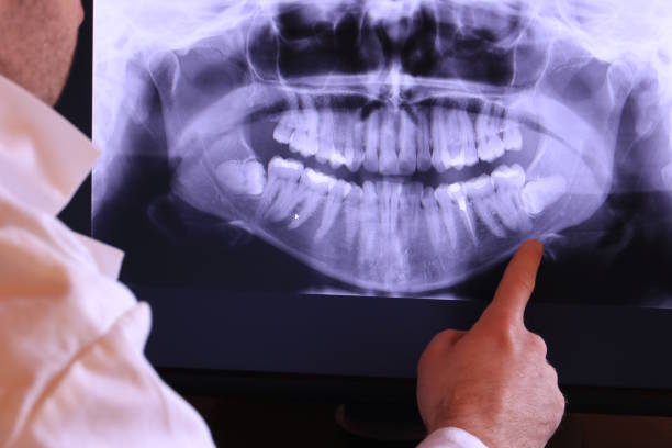 Best Pediatric Emergency Dentist in Montvale, NJ