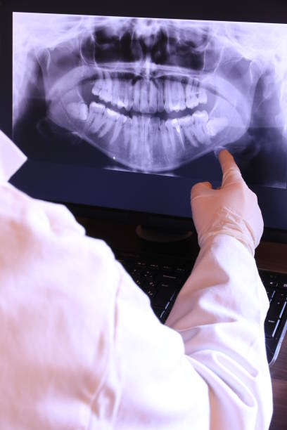Best Emergency Treatment for Toothache in Montvale, NJ